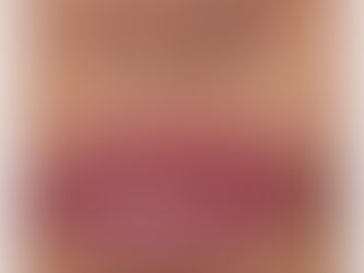 Warum die natürliche Lippenlinie so wichtig ist – und was passiert, wenn man sie zu sehr vergrößert