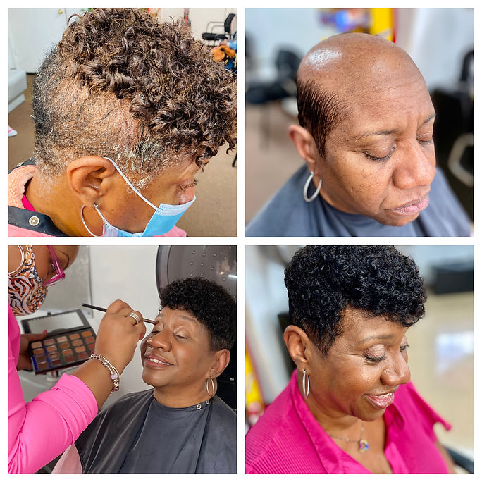 Before and After Alopecia Solutions