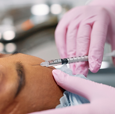Professional dermal filler treatment at Bishopbriggs skin clinic 2