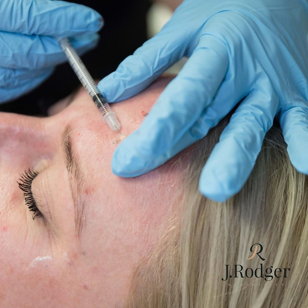 anti-wrinkle injections