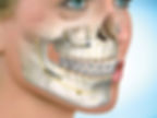face bone repair