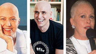 A Queda de Cabelo, A Alopecia