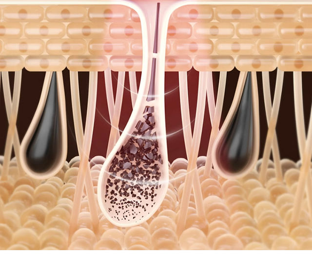 Thumbnail: Laser Epilator Hair Trimmer Shaver Remover Bikinis Razor Hair Cutting 