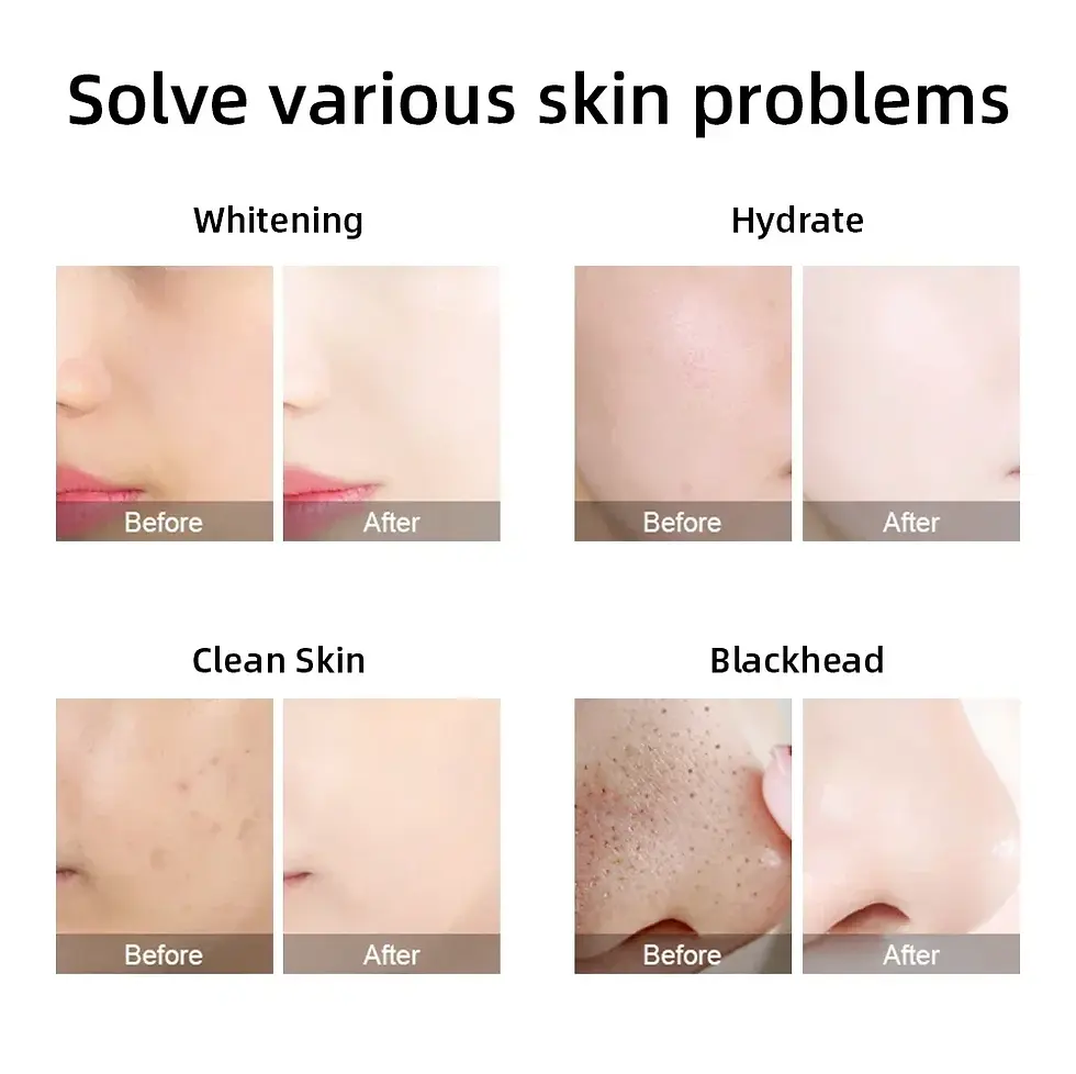 Thumbnail: Hydro Water Jet Peel Hydro dermabrasion Machine Facial Hydra Skin Care Machine