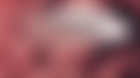 APA YANG PATUT DIELAKKAN UNTUK SKIN CONCERN ROSACEA?