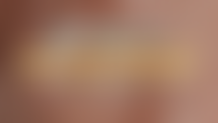 APA ITU COLLAGEN DAN DARI MANA IA DATANG?