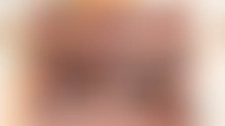 APAKAH PROSEDUER KOSMETIK YANG BIASA UNTUK MASALAH JERAWAT?