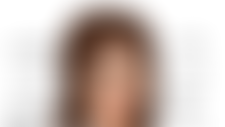 [QUICK INFO] JENIS-JENIS KEDUTAN PADA KULIT WAJAH