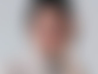 Natural Botox appointment in Dunedin results