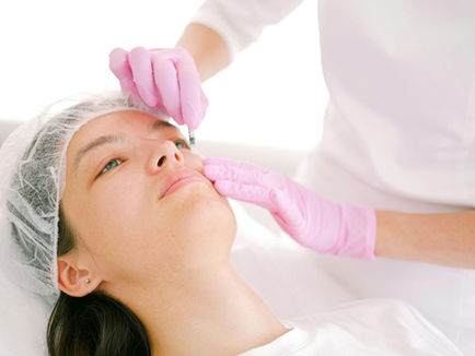 A Marlow beauty junkie's blog: Microneedling 