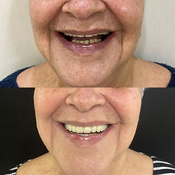 Antes-de-Depois-2-1024x1024.jpeg