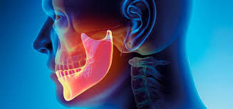 Osteoporose e Seus Impactos na Odontologia
