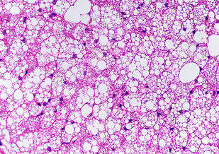 Low-protein diet triggers mice’s gut bacteria to burn calories