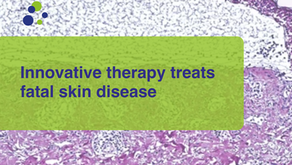 Innovative therapy treats fatal skin disease