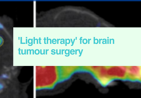 Shedding light on brain tumours