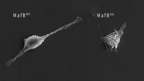 Important immunity gene switch identified in mice