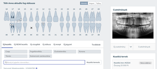 Képernyőfotó 2021-08-04 - 11.12.36.png