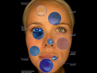 How We Can Make an Accurate Skin Diagnosis with the Observ Machine