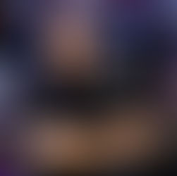 Революція у видаленні татуювань: безпечні та безболісні методи