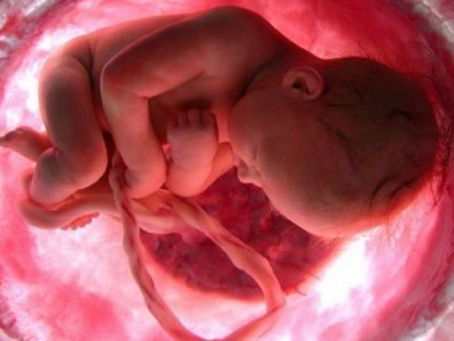 TEXAS OBLIGARA A ENTERRAR O INCINERAR RESTOS FETALES TRAS ABORTAR