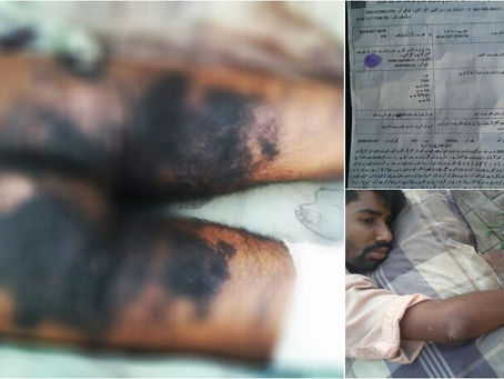 PAKISTAN: SECUESTRAN AL AMIGO DE SU HIJA Y LO TORTURAN CON BARRAS DE HIERRO HIRVIENDO "POR SER 