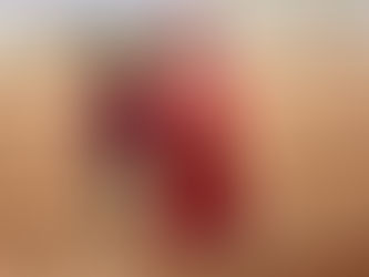 ESTRÉS, DEPRESIÓN O PÉRDIDA DEL HABLA, LAS CONSECUENCIAS IRREVERSIBLES DE SEIS AÑOS DE GUERRA EN LOS