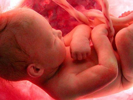 EL SENADO DE CHILE DA SI AL ABORTO Y NO AL DERECHO POR NACER