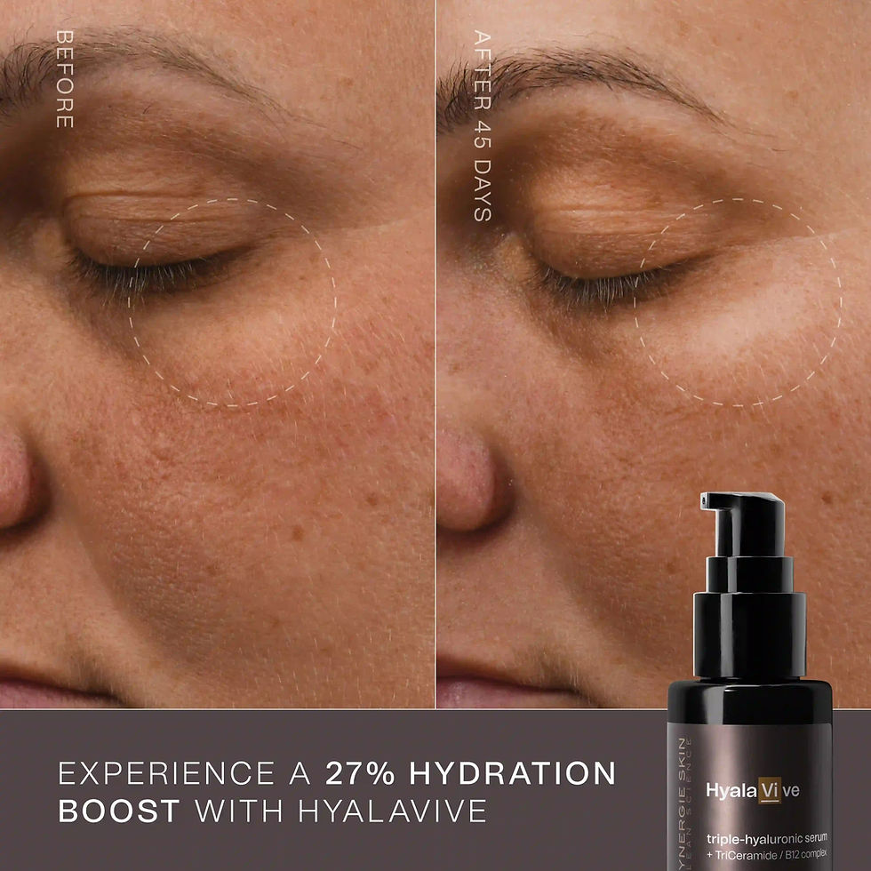 Thumbnail: HyalaVive