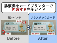 診察券をカードプリンターで内製する完全ガイド｜紙・パウチ運用からプラスチックカードへの移行を徹底解説
