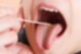Oral Feeding and Swallowing Disorders