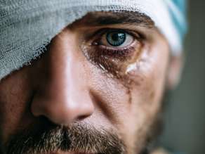 חטפתי שבב לעין. לא קרה כלום. עד שקרה.