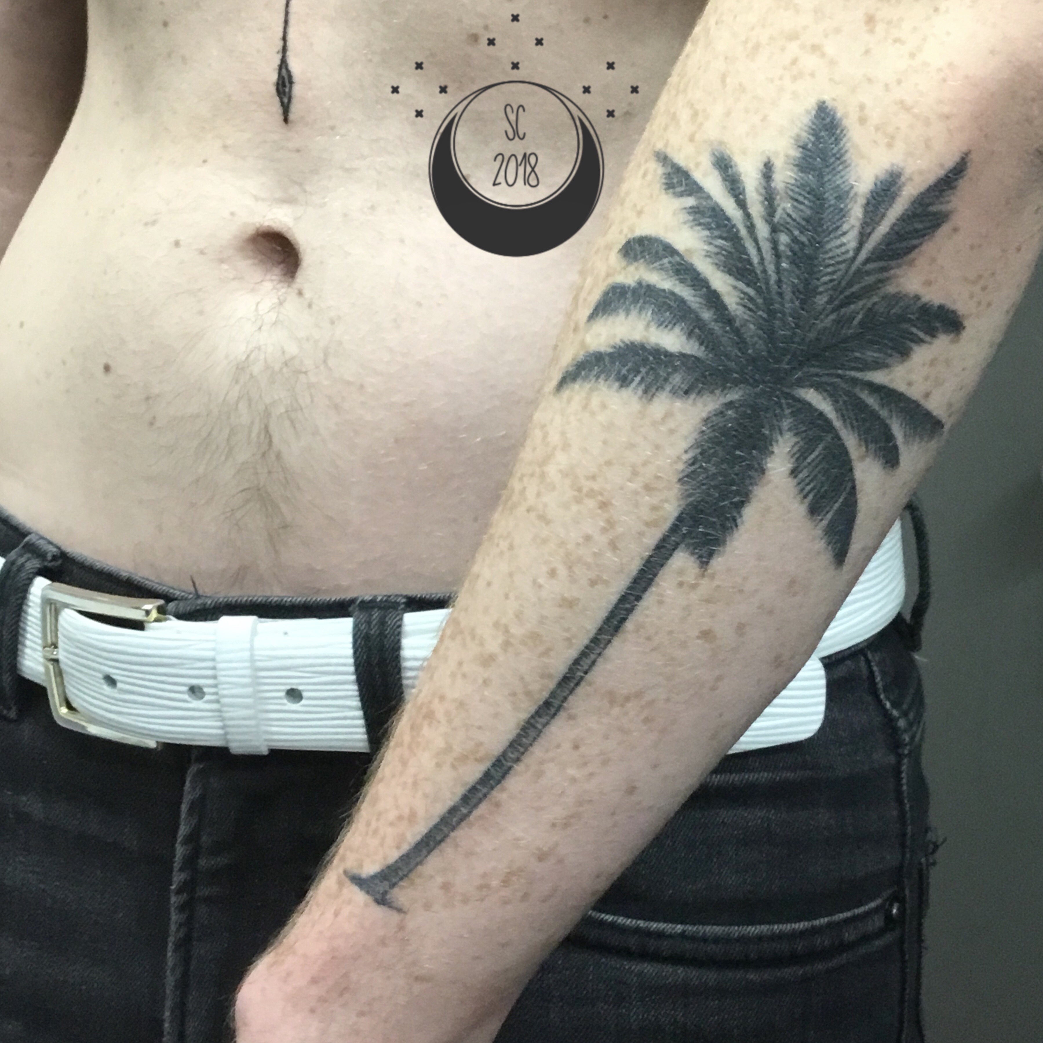 Healed Palm Tree