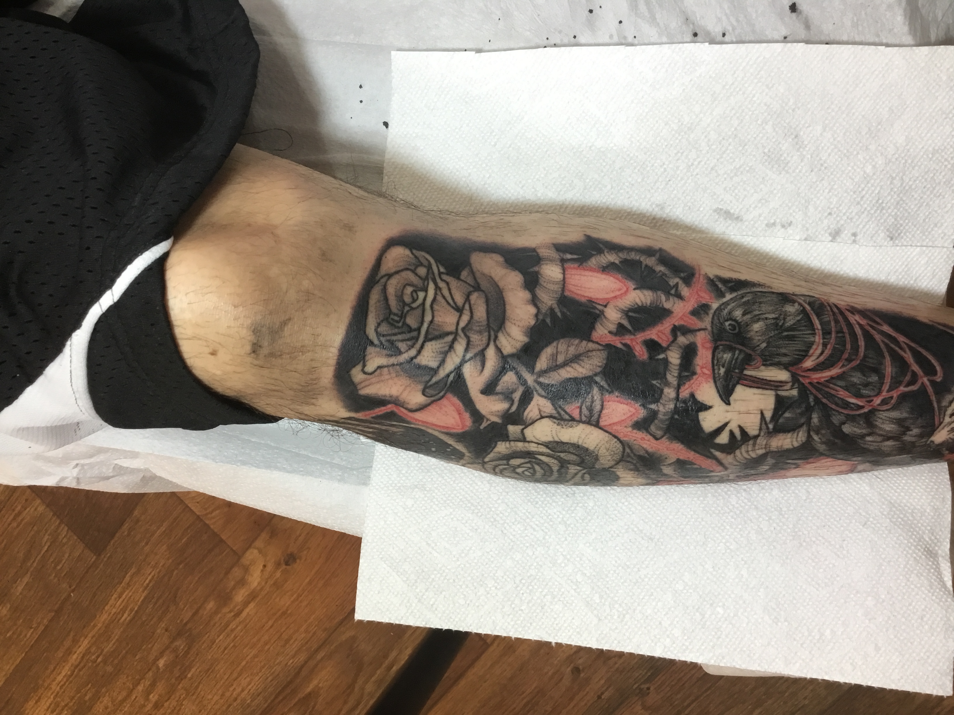 Joaquin's Shin