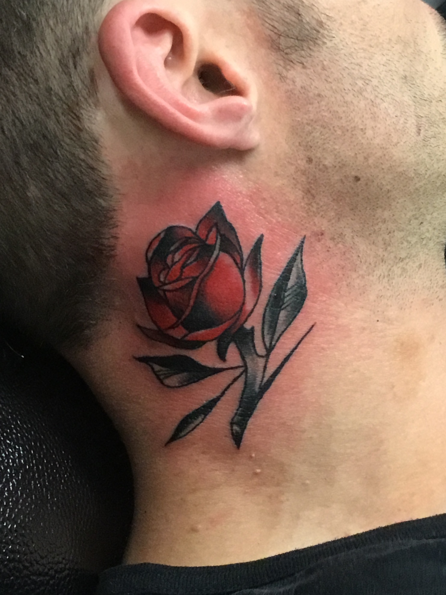 tony rose neck2