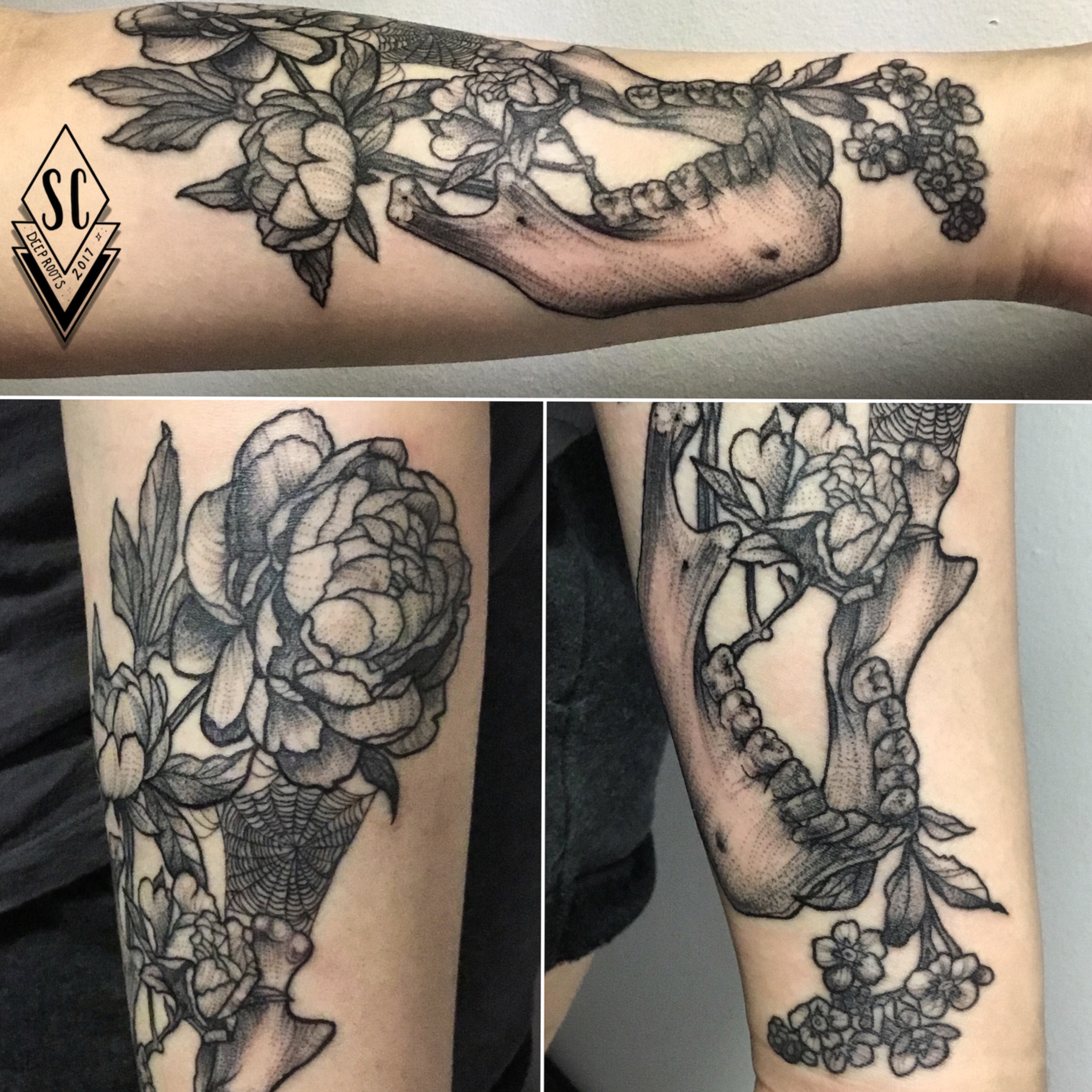 Mandible arm
