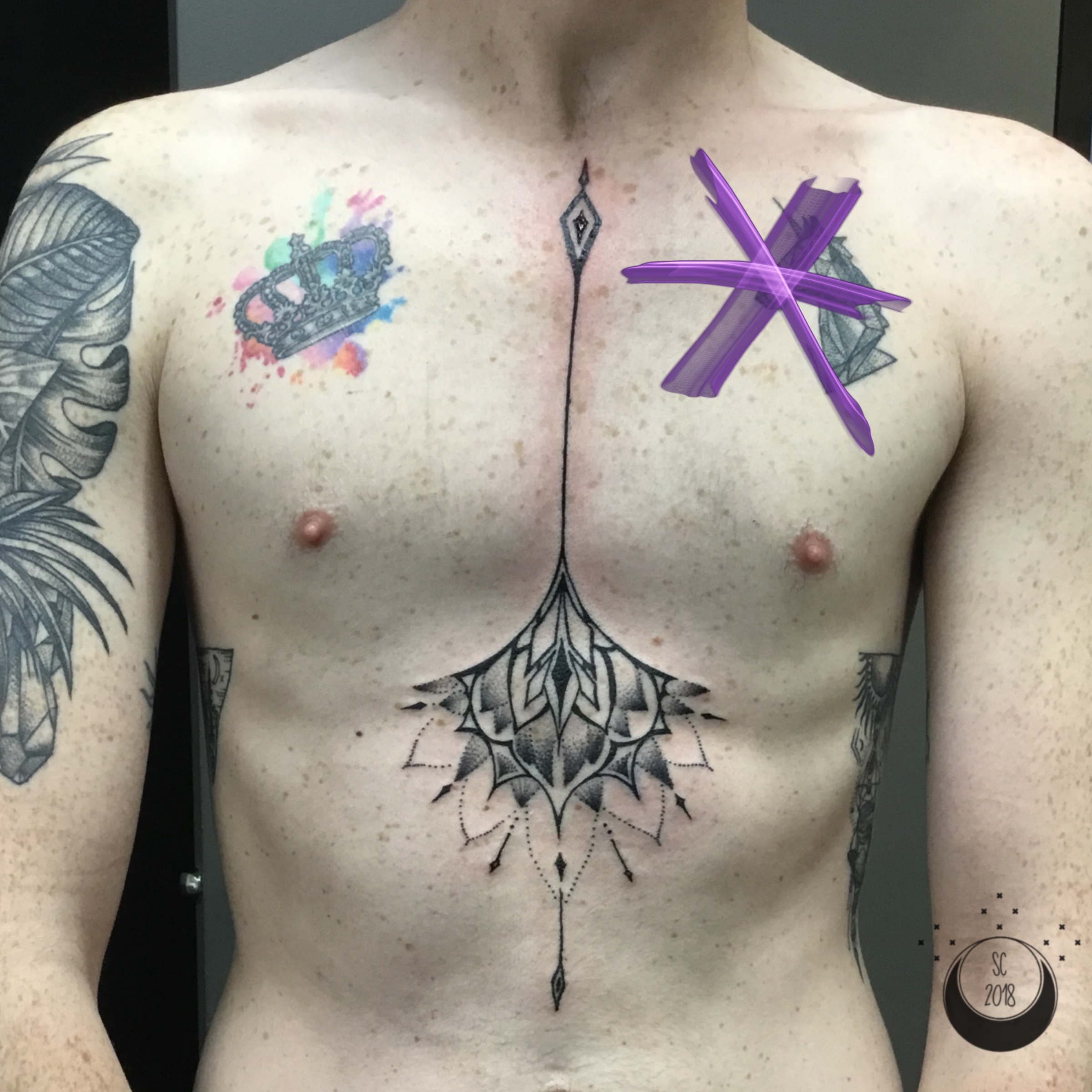 ChandlerSternum