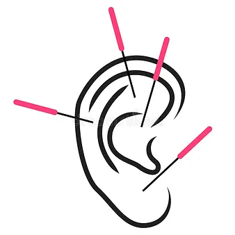Auricular Acupuncture