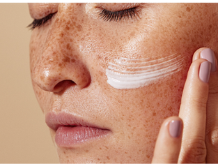 Sun spots tratment at DermaClinic Bristol