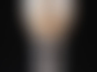 Lucrare provizorie pe implant dentar