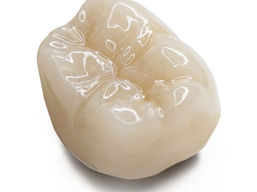 coroana dentara design