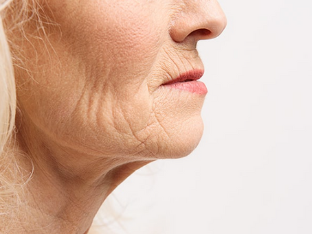 Rimpels op de kin: oorzaken, behandelingen en preventie