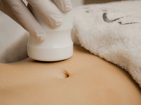 Cavitatie: werking, effectiviteit en toepassingen in de esthetische geneeskunde