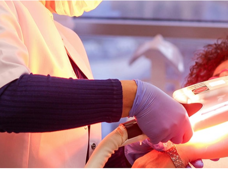 Diode laserontharing: werking, voordelen en aandachtspunten