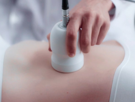 Cavitatie en ultrasound: wat is het verschil?