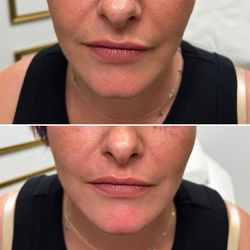 breagha aesthetics 5