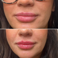 breagha aesthetics 9