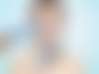 Rinoplastia Cerrada – Sin incisiones