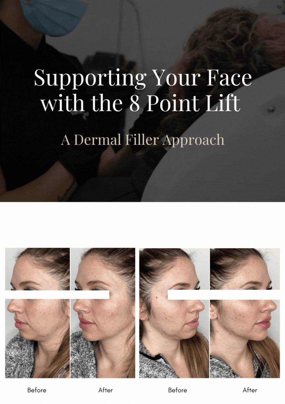 Supporting Your Face With the 8 Point Lift
