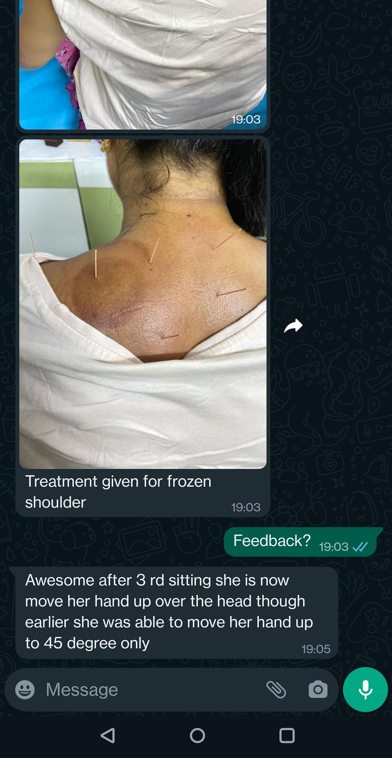 Acupuncture Courses