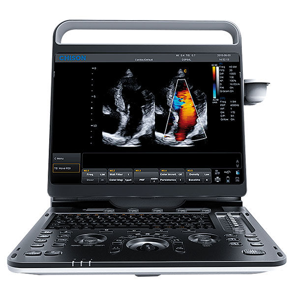 Ultrasonido portátil Doppler color CHISON EBit 60